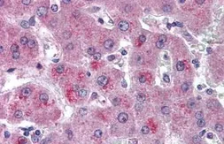 Anti-HTRA3 antibody used in IHC (Paraffin sections) (IHC-P). GTX85675