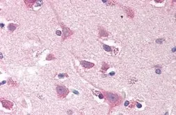 Anti-SMOC2 antibody used in IHC (Paraffin sections) (IHC-P). GTX85703