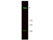 Anti-RIF1 antibody used in Western Blot (WB). GTX85728