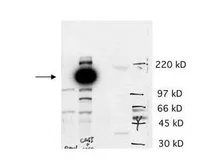 Anti-CASZ1 antibody used in Western Blot (WB). GTX85729
