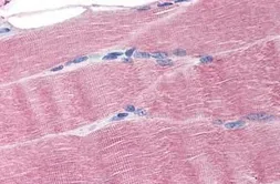 Anti-Ferroportin 1 antibody used in IHC (Paraffin sections) (IHC-P). GTX85744