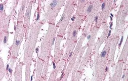 Anti-ATG4B antibody used in IHC (Paraffin sections) (IHC-P). GTX85759