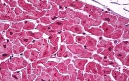 Anti-Podoplanin antibody [5E2] used in IHC (Paraffin sections) (IHC-P). GTX85772