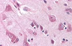 Anti-Noxa antibody used in IHC (Paraffin sections) (IHC-P). GTX85836
