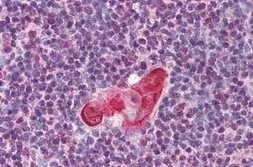 Anti-TLX1 antibody used in IHC (Paraffin sections) (IHC-P). GTX85867
