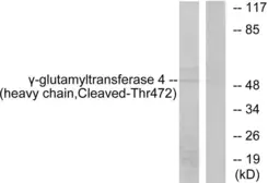 Anti-GGT7 (cleaved Arg472) antibody used in Western Blot (WB). GTX86892