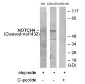 Anti-NOTCH4 (cleaved Val1432) antibody used in Western Blot (WB). GTX86910
