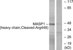 Anti-MASP1 (cleaved Arg448) antibody used in Western Blot (WB). GTX86929