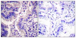 Anti-Caspase 9 (cleaved Asp315) antibody used in IHC (Paraffin sections) (IHC-P). GTX86945