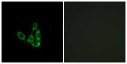 Anti-GCNT3 antibody used in Immunocytochemistry/ Immunofluorescence (ICC/IF). GTX87025