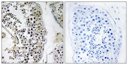 Anti-CEP170 antibody used in IHC (Paraffin sections) (IHC-P). GTX87061