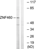 Anti-ZNF460 antibody used in Western Blot (WB). GTX87066