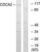 Anti-CDCA2 antibody used in Western Blot (WB). GTX87138