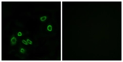 Anti-BRP44L antibody used in Immunocytochemistry/ Immunofluorescence (ICC/IF). GTX87153