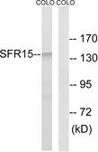 Anti-SFRS15 antibody used in Western Blot (WB). GTX87159