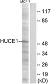 Anti-HUCE1 antibody used in Western Blot (WB). GTX87185