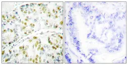 Anti-Ataxin 1 antibody used in IHC (Paraffin sections) (IHC-P). GTX87190