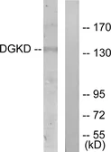 Anti-DGKD antibody used in Western Blot (WB). GTX87254