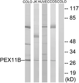 Anti-PEX11B antibody used in Western Blot (WB). GTX87266