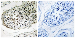 Anti-UBQLN3 antibody used in IHC (Paraffin sections) (IHC-P). GTX87400