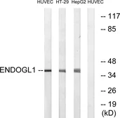 Anti-ENDOGL1 antibody used in Western Blot (WB). GTX87406