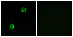 Anti-Apolipoprotein L2 antibody used in Immunocytochemistry/ Immunofluorescence (ICC/IF). GTX87407