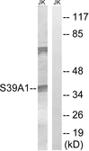Anti-ZIP1 antibody used in Western Blot (WB). GTX87436