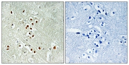 Anti-GADD45GIP1 antibody used in IHC (Paraffin sections) (IHC-P). GTX87447