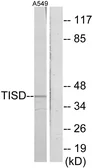 Anti-TIS11D antibody used in Western Blot (WB). GTX87458