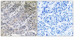 Anti-BRP44 antibody used in IHC (Paraffin sections) (IHC-P). GTX87481