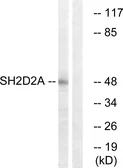 Anti-SH2D2A antibody used in Western Blot (WB). GTX87514