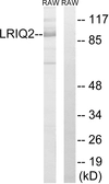 Anti-CEP97 antibody used in Western Blot (WB). GTX87528