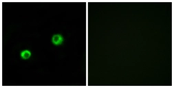 Anti-ARSI antibody used in Immunocytochemistry/ Immunofluorescence (ICC/IF). GTX87576