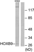 Anti-HOXB9 antibody used in Western Blot (WB). GTX87588