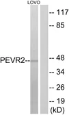 Anti-PEVR2 antibody used in Western Blot (WB). GTX87668