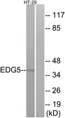Anti-S1PR2 antibody used in Western Blot (WB). GTX87713