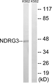Anti-NDRG3 antibody used in Western Blot (WB). GTX87787