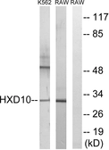 Anti-HOXD10 antibody used in Western Blot (WB). GTX87854
