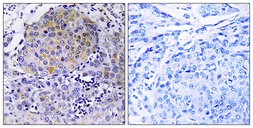 Anti-CEP78 antibody used in IHC (Paraffin sections) (IHC-P). GTX87967
