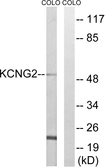 Anti-KCNG2 antibody used in Western Blot (WB). GTX87981