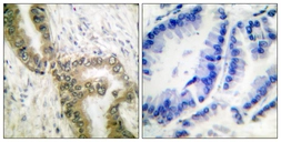 Anti-p53 (acetyl Lys386) antibody used in IHC (Paraffin sections) (IHC-P). GTX88009