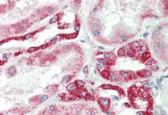 Anti-NDUFS6 antibody, Internal used in IHC (Paraffin sections) (IHC-P). GTX88043