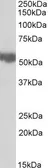 Anti-ALDH3A2 antibody, Internal used in Western Blot (WB). GTX88083