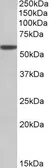 Anti-ALDH3A1 antibody, C-term used in Western Blot (WB). GTX88085