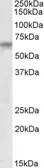 Anti-TTC8 antibody, Internal used in Western Blot (WB). GTX88117