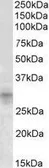 Anti-IGFBP7 antibody, Internal used in Western Blot (WB). GTX88132