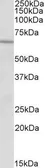 Anti-ACADVL antibody, N-term used in Western Blot (WB). GTX88173