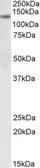 Anti-DIAPH1 antibody, Internal used in Western Blot (WB). GTX88212