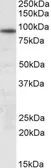 Anti-UNC45B antibody, Internal used in Western Blot (WB). GTX88214