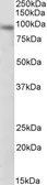 Anti-DTX3 antibody, Internal (near N-term) used in Western Blot (WB). GTX88228